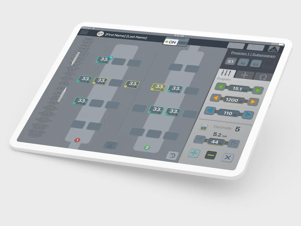 Algovita SCS clinician application on a tablet, showing spinal leads and program controls